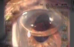 Escaf Nucleus Instruments